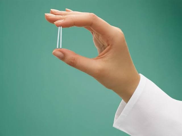 PLANOS DE SAÚDE TERÃO DE OFERECER IMPLANTE CONTRACEPTIVO HORMONAL