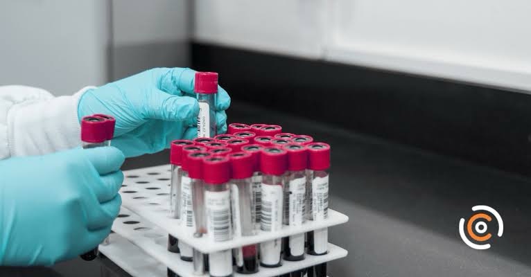 Cientistas brasileiros avançam diagnóstico de Alzheimer por exame de sangue