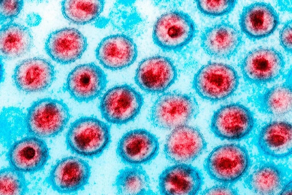 HIV: dois novos casos de cura são anunciados; total chega a 13